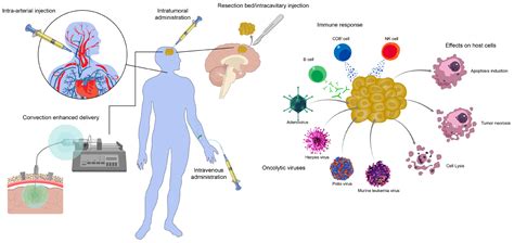 glioblastoma treatment with polio virus